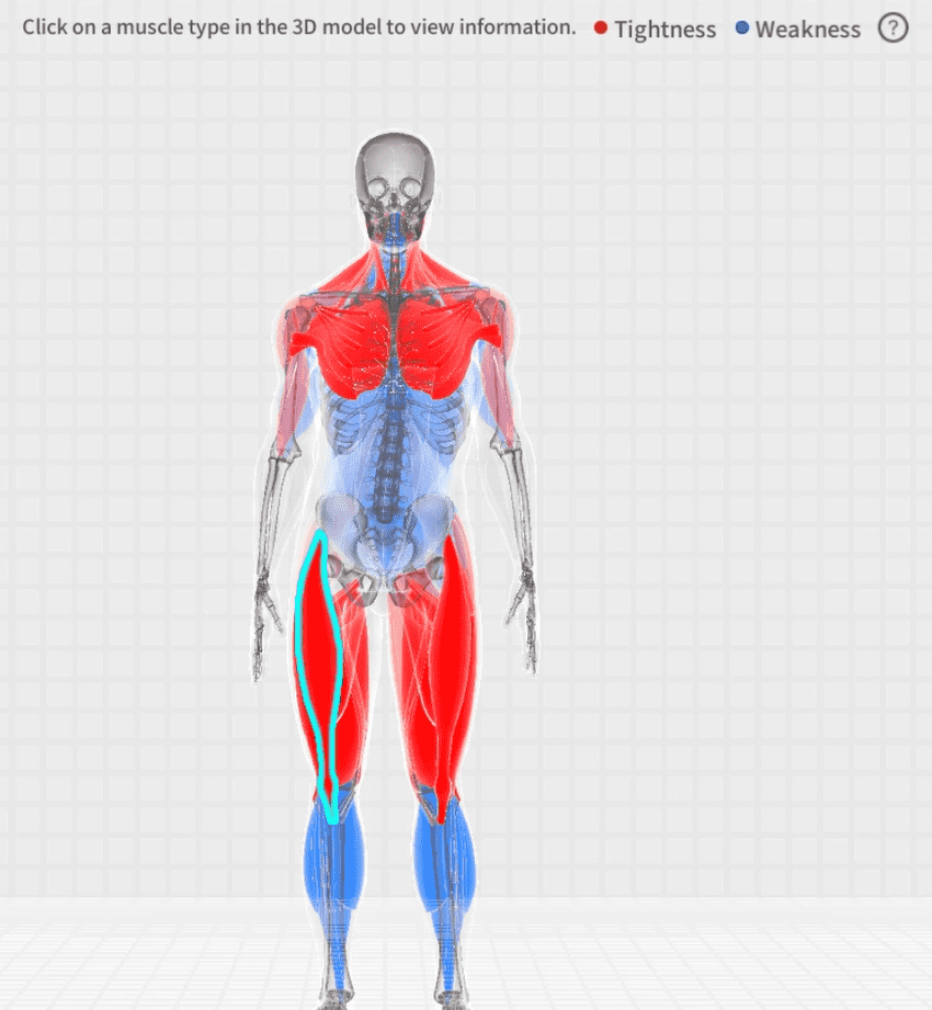 Posture Analysis