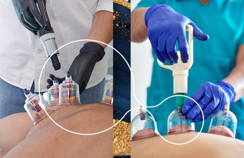 Copy of Difference between Dry Cupping & Wet Cupping (2)